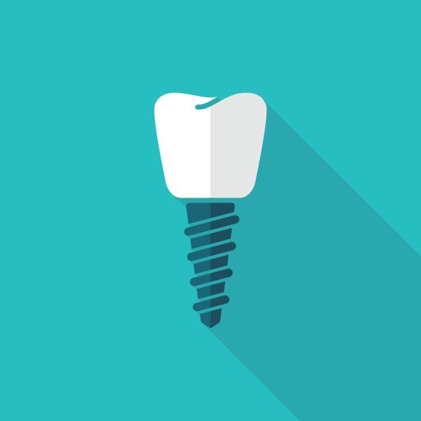 dental implants Camdenton, MO