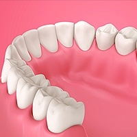 Gum Disease Camdenton, MO