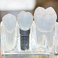 Prosthodontist
