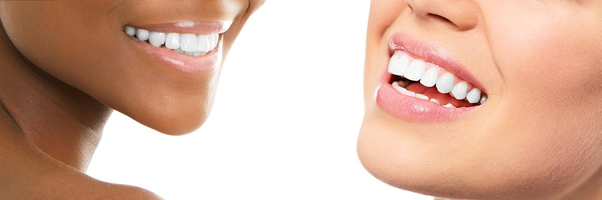 Camdenton Teeth Whitening