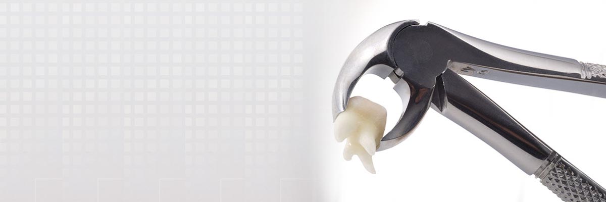 Camdenton Tooth Extraction